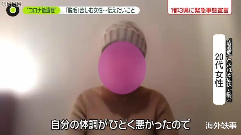 日本女子確診後靠抗體自愈，後遺癥頭發狂掉！日本女生：真的怕瞭-圖9