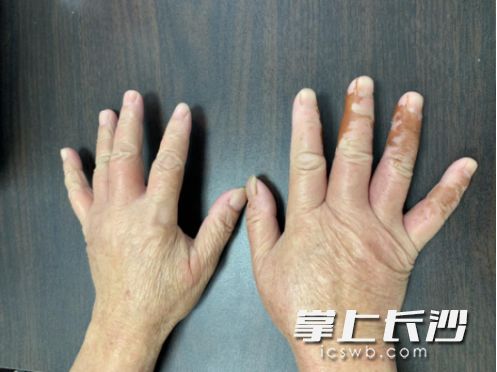 天眼新闻|严重可致命！贵阳街头这东西，千万别乱采