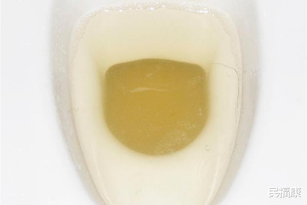 绿豆|身上哪些部位有味道,说明肾脏出毛病了?已闻到臭味,要抓紧查