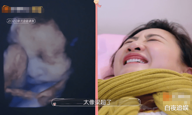 『央视』何雯娜未婚先孕,谁注意到丈夫看她的眼神?是不是真爱很明显!