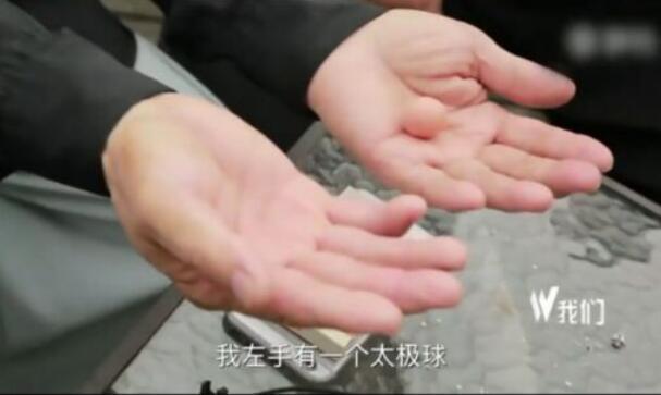 「马保国」马保国终于找出与众不同的败因：比赛时突然浑身乏力，全身瘫软