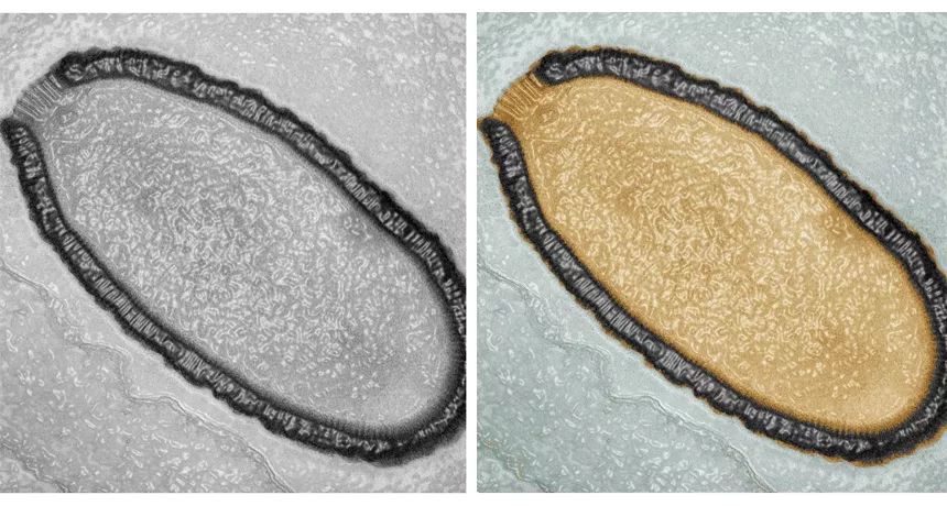 「霍金」“霍金：“曾预言21世纪冲击人类的不是人工AI而是病毒？”