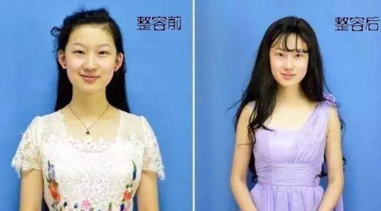 刘亦菲|19岁花百万整容成刘亦菲，名字也像高仿刘亦菲，如今23岁成这样！