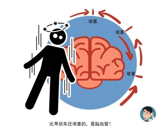 中风|血管变窄的男人,通常有4个特征,若占3个以上,可能中风正在靠近