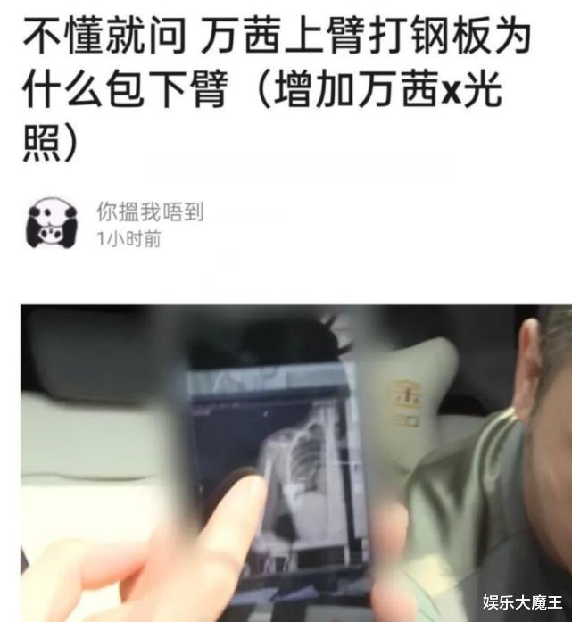 万茜|万茜骨折恢复太快被嘲“医学奇迹”,工作室首度公开手术伤口令人触目惊心