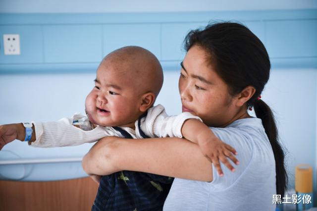 黑土影像|贵州2岁女童半张脸被巨大肿瘤挤占，每天上万治疗费，父亲崩溃了