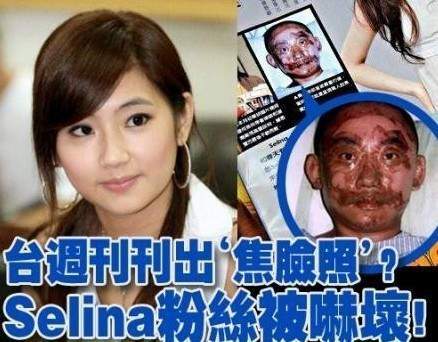 Selina|被火吻的Selina得丈夫不离不弃，暖心丈夫却在背后说看见她想吐