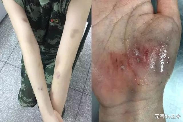 张馨予|张馨予被婆家嫌弃学历低，最终还是靠性格和行动，征服了军人世家