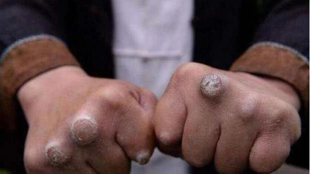 李小龙▲那么多“武打”明星，却只有4位高手有拳茧，网友: 这才是真功夫