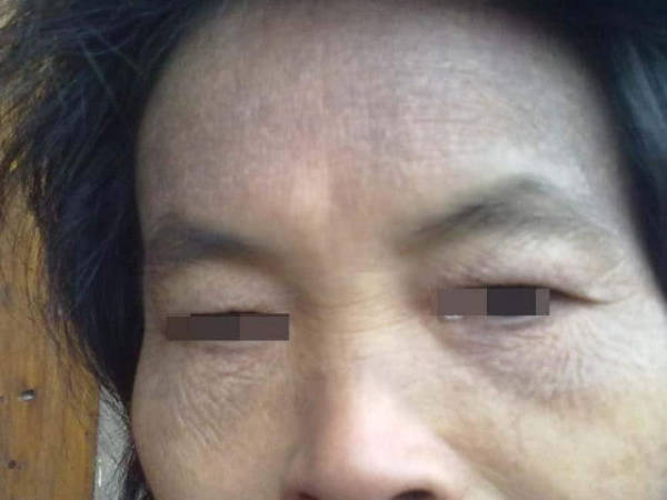 []肾功能“稀烂”的男生，头部会有3处亮红灯，祝你一个都没有