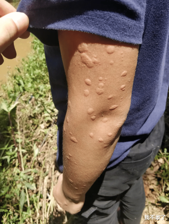 |“有什么工作是你做了一次，以后都不会再做的工作？”哈哈哈鹤顶红品鉴过分了