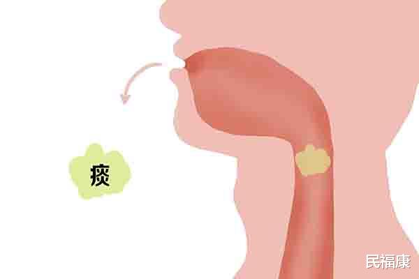 咳嗽|喉咙里的痰，能直接咽下去吗？白痰和黄痰，有什么不同？