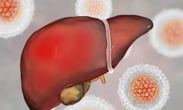 肝癌@50岁男子，查出肝癌，提醒：出现“1痣2臭”，快查查肝