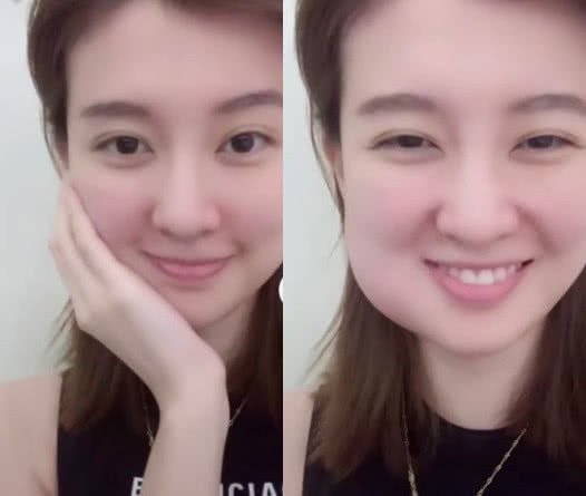 周冬雨拔智齿后晒自拍，半张脸引发网友脑洞，心疼又好笑！