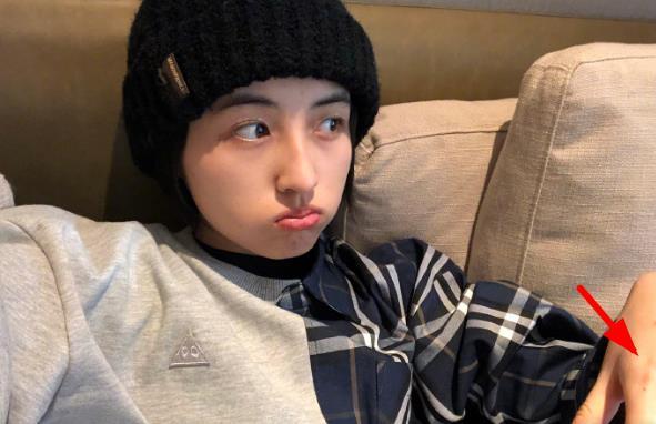 张子枫|张子枫不愧是“张不修”，晒自拍额头痘印都不p，脸上还有雀斑