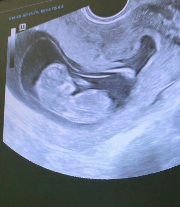 英国英鸟|狗血！俄35岁女子出轨20岁继子，怀上对方孩子并正式登记结婚