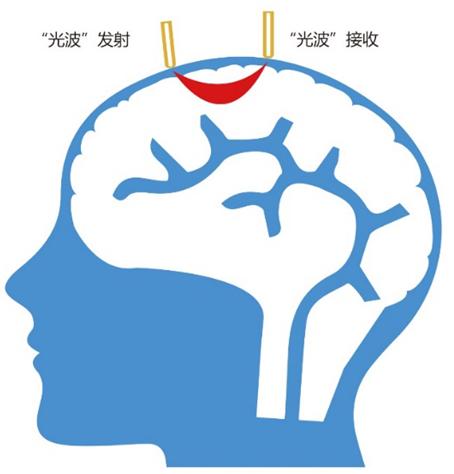 A轮融资|专注脑功能医疗设备,「慧创医疗」完成上千万元A轮融资