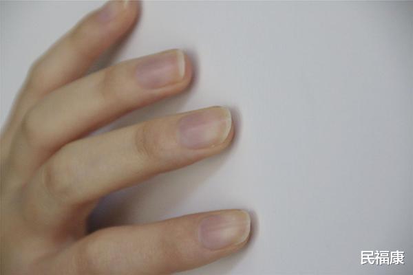 疾病|指甲上有竖纹，暗示体内有大病？指甲上的秘密，是时候揭开了