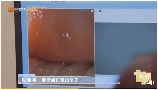 杨迪|34岁知名男星自曝身体亮红灯：多少成年人，被上瘾性行为榨干