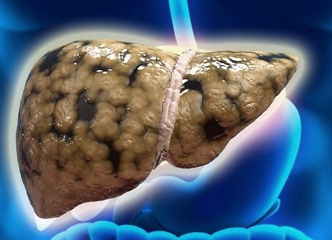 『玉米』夏天养肝护肝就吃这两道菜，既可补肝血又可清肝毒