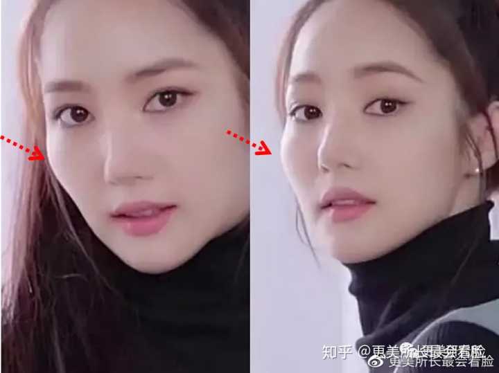 朴敏英|有没有那种颧骨高而很好看的女生？