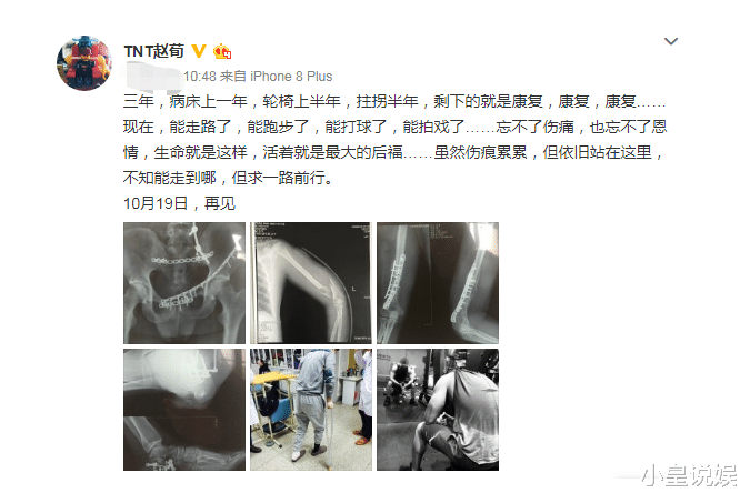 赵荀|拍一部戏用8个替身,整个剧组等他半年,却没人敢说他耍大牌