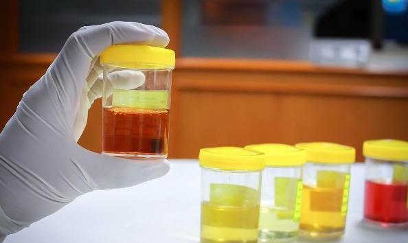 肝脏■一家三口被确诊肝病,医生再次提醒:这种日用品,超过一年就得扔