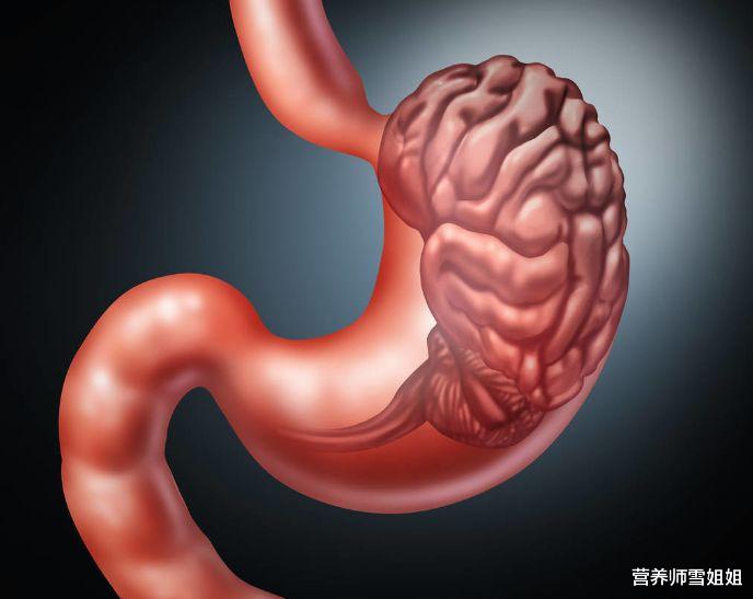 #胃癌#28岁女子，胃癌晚期，提醒：“饭后”3种异常，最好查一下胃镜