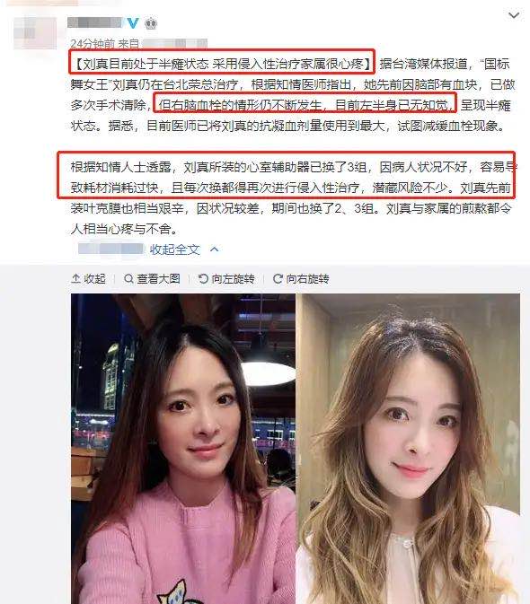 「刘真」最新!知情人透露刘真已半瘫,体重仅剩30几公斤