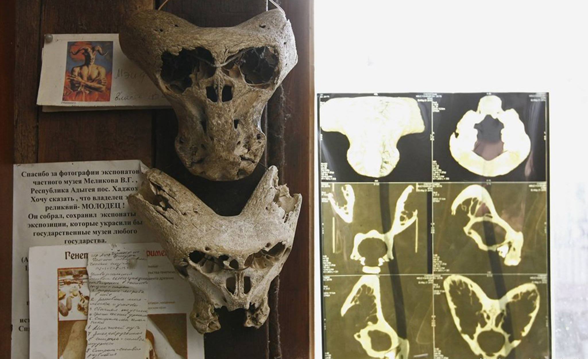 【外星生物】德国曾秘密接触外星生物？俄现奇异生物颅骨，附近又找到德国皮箱