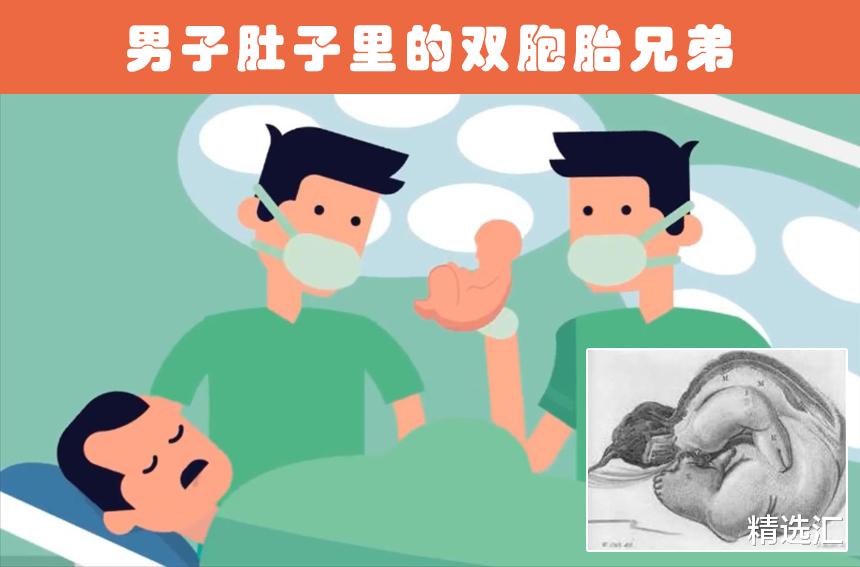 医生|人体内的意外发现：在人类体内找到的5个意外的事物