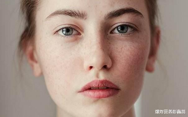 老年斑@为什么有些女性脸上容易长斑？3个原因中，都可以通过自己改善