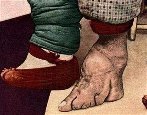 『』民国小脚夫人:靠小脚嫁大户,每次洗脚都疼到崩溃,丈夫却很喜欢
