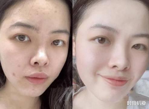 马鞭草|满脸都是“颗粒物”，不痛不痒但超碍眼，那你平时应该没少做这事