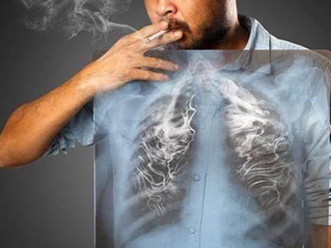 疾病|为什么有的老人一直抽烟，身体却没毛病？医生：这3个习惯帮了忙