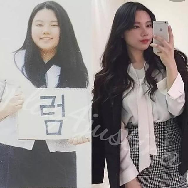 健身|体重320斤的胖妞减肥成功后,却被减肥后的赘皮搞得痛不欲生…