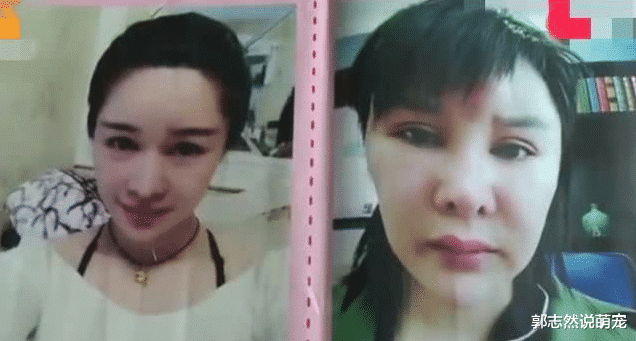 女子花27万不断动脸，8个月后老了10岁！网友：看着眼熟