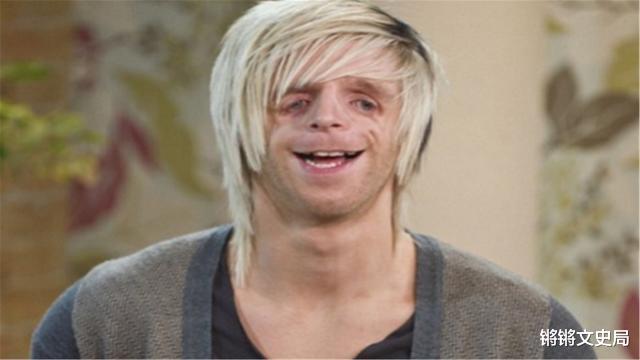 锵锵文史局|男子天生脸部畸形,靠才华娶得美貌妻子,不顾反对再生畸形儿