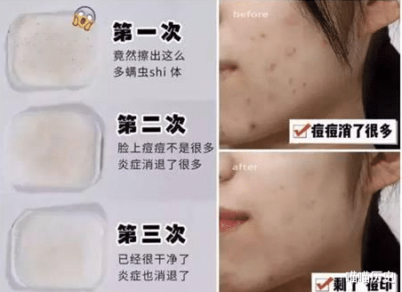 氨基酸|自以为是在护肤，其实很“伤”皮肤的4种习惯，难怪皮肤一直不好