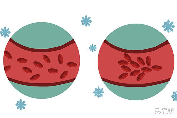 花椒|厨房常见1物，或是“祛湿高手”，泡脚水里放一些，止痒又助眠