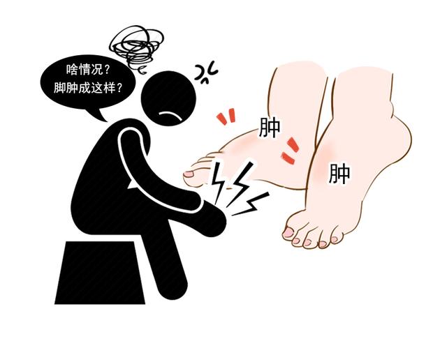[肾衰竭]肾衰竭早期，患者会出现这三个异常表现，需及时进行肾功能筛查