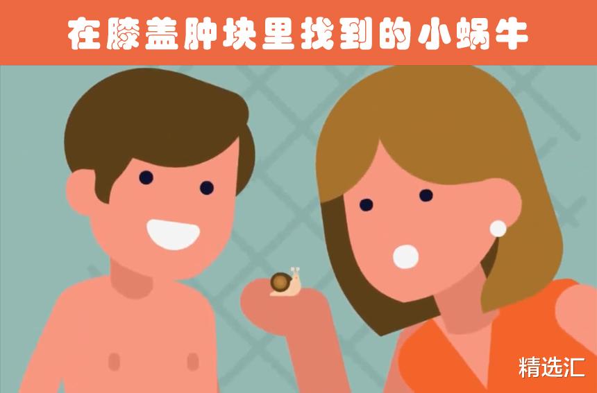 医生|人体内的意外发现：在人类体内找到的5个意外的事物