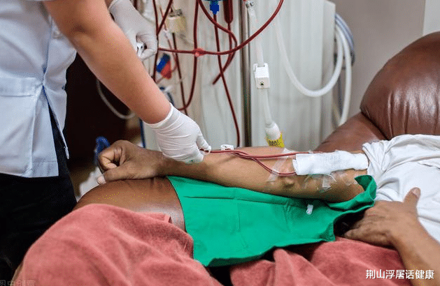 尿酸|42岁男子尿酸高达900，出现肾衰竭，只因贪吃了这种“补品”