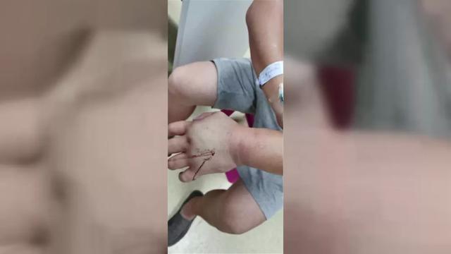 河南都市频道|吓人！车上发现一根“枯树枝”，司机伸手去拿后在医院抢救了一天