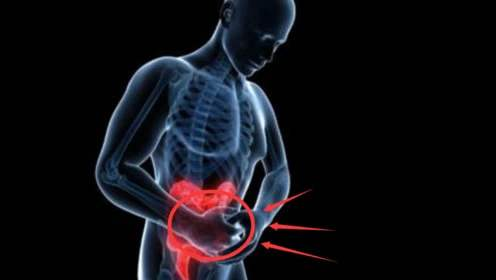 胃癌|60岁女子，确诊胃癌，医生怒斥：炒菜加1物，胃癌来找你