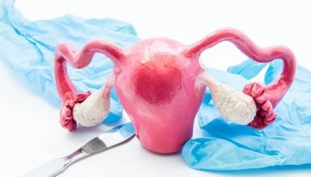 宫颈癌|宫颈病变的第1个“征兆”，常常表现在月经上，若有，劝你早查HPV