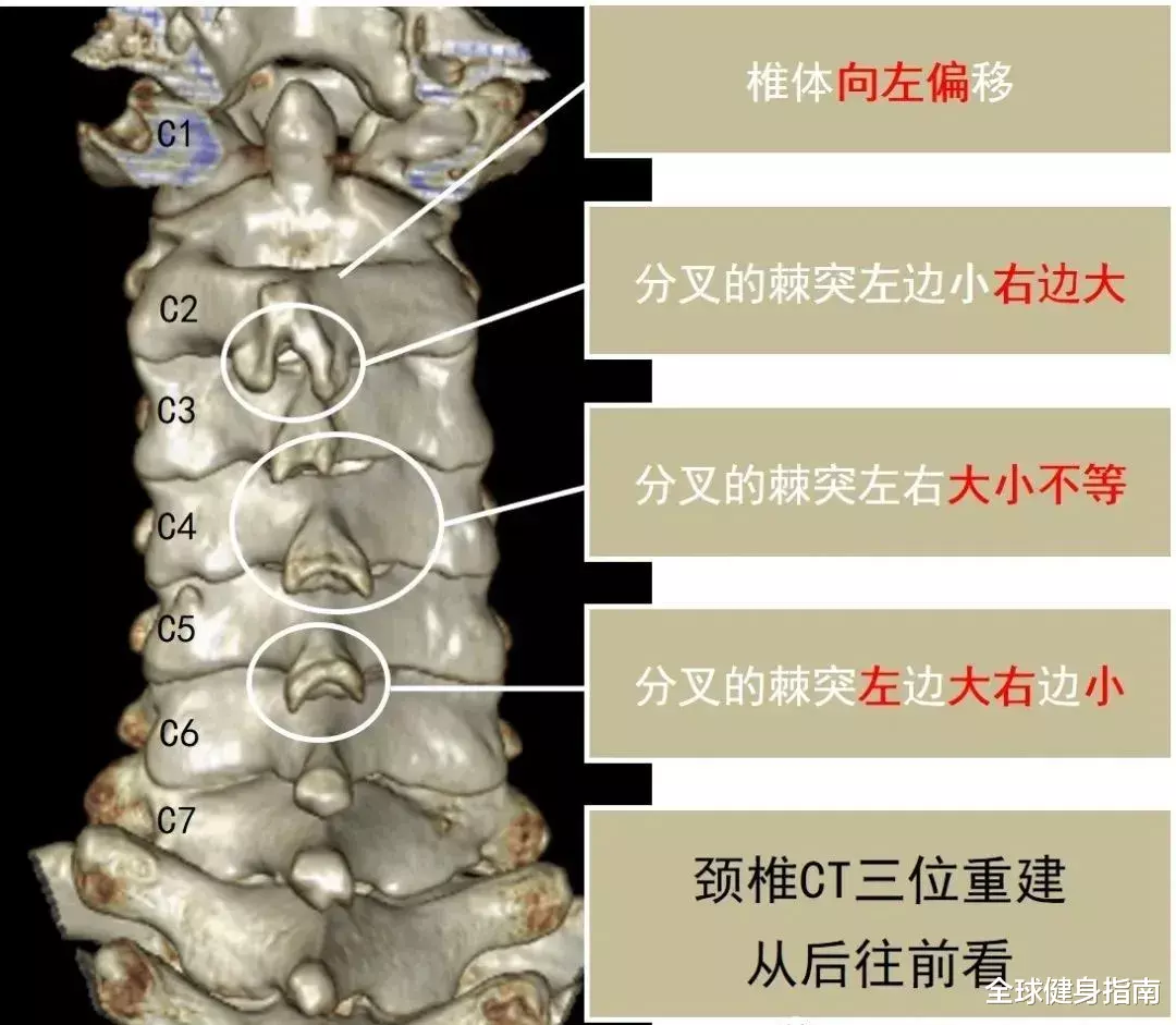 医生|想学杨幂的正骨大法？劝你慎重！