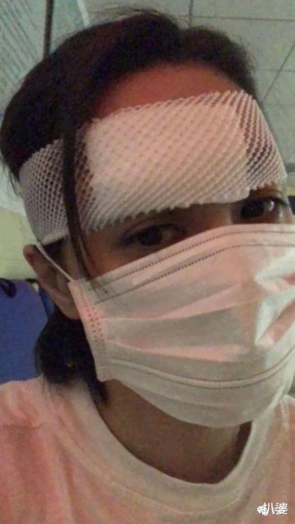 阿娇|离奇受伤的阿娇，又有新故事了。