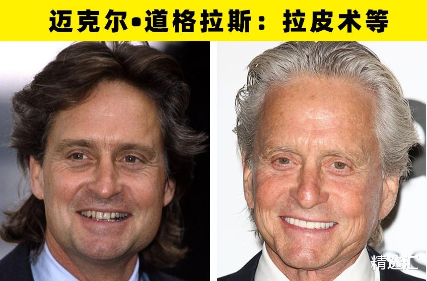 整形|大方承认自己做过整形手术的8名好莱坞明星