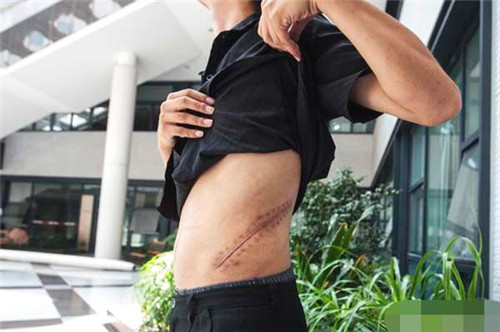 iPhone|8年前，那个卖肾买苹果手机，获赔227万的17岁少年，现状让人唏嘘